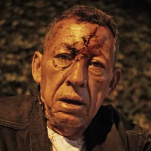 Man With Stitches And Hospital Gown - Men and Women of Los Angeles